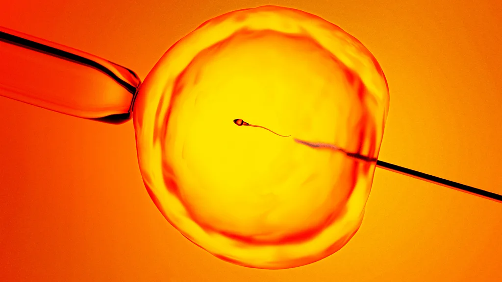 Finding ‘hidden sperm’: New technique offers hope to men previously told they were infertile